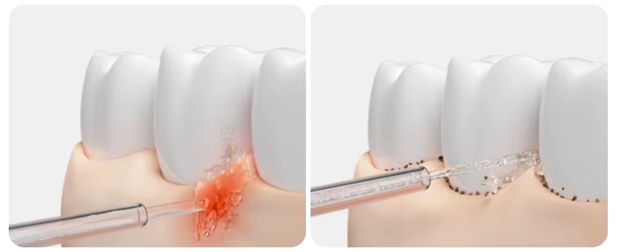 Mijia-Electric-Flusher-2-MEO705-02